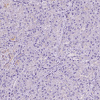 Immunohistochemical staining of human pancreas shows weak cytoplasmic positivity in exocrine glandular cells.
