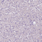 Immunohistochemical staining of human liver shows negative positivity in hepatocytes as expected.