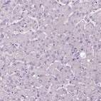 Immunohistochemical staining of human liver shows negative positivity in hepatocytes as expected.