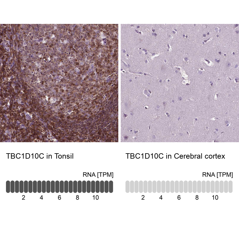 Anti-TBC1D10C Antibody
