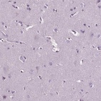 Anti-TBC1D10C Antibody