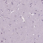 Immunohistochemical staining of human cerebral cortex shows low expression as expected.