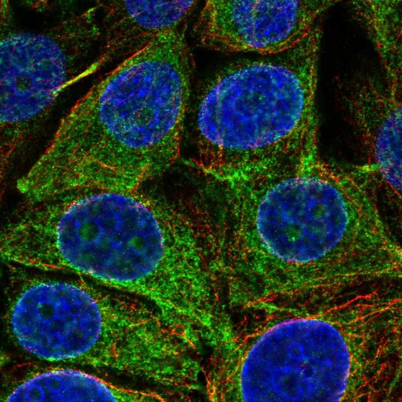 Anti-REEP5 Antibody