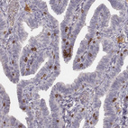 Immunohistochemical staining of human fallopian tube shows strong membranous positivity in lymphoid cells.