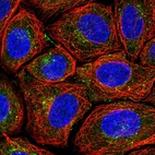 Immunofluorescent staining of human cell line SiHa shows localization to cytosol & the Golgi apparatus.
