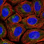 Immunofluorescent staining of human cell line SiHa shows localization to cytosol & the Golgi apparatus.