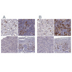 Immunohistochemical staining of human liver, lymph node, pancreas and skin using Anti-CCNF antibody HPA070495 (A) shows similar protein distribution across tissues to independent antibody HPA071600 (B).