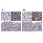 Immunohistochemical staining of human liver, lymph node, pancreas and skin using Anti-CCNF antibody HPA070495 (A) shows similar protein distribution across tissues to independent antibody HPA071600 (B).
