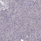 Anti-CCNF Antibody