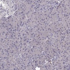 Immunohistochemical staining of human pancreas shows low expression as expected.