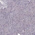 Immunohistochemical staining of human pancreas shows low expression as expected.