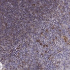 Immunohistochemical staining of human tonsil shows high expression.