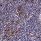 Immunohistochemical staining of human lymph node using Anti-CCNF antibody HPA070495.