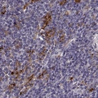 Immunohistochemical staining of human lymph node using Anti-CCNF antibody HPA070495.