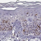 Immunohistochemical staining of human skin using Anti-CCNF antibody HPA070495.