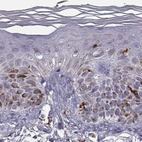 Immunohistochemical staining of human skin using Anti-CCNF antibody HPA070495.