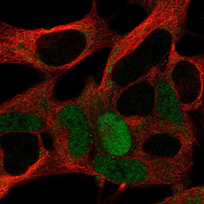 Anti-MAGEA10 Antibody