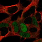 Anti-MAGEA10 Antibody