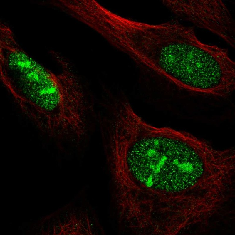 Anti-NOC3L Antibody