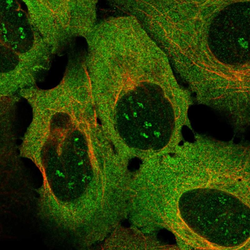 Anti-TNFRSF9 Antibody