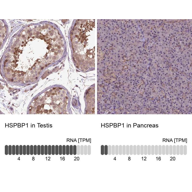 Anti-HSPBP1 Antibody