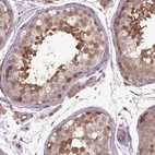 Immunohistochemical staining of human testis shows high expression.