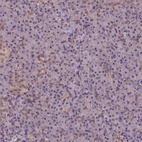 Anti-HSPBP1 Antibody