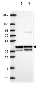 Lane 1: Marker [kDa] 250, 130, 95, 72, 55, 36, 28, 17, 10_br/_Lane 2: Human cell line RT-4_br/_Lane 3: Human cell line U-251 MG