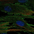 Anti-RECK Antibody