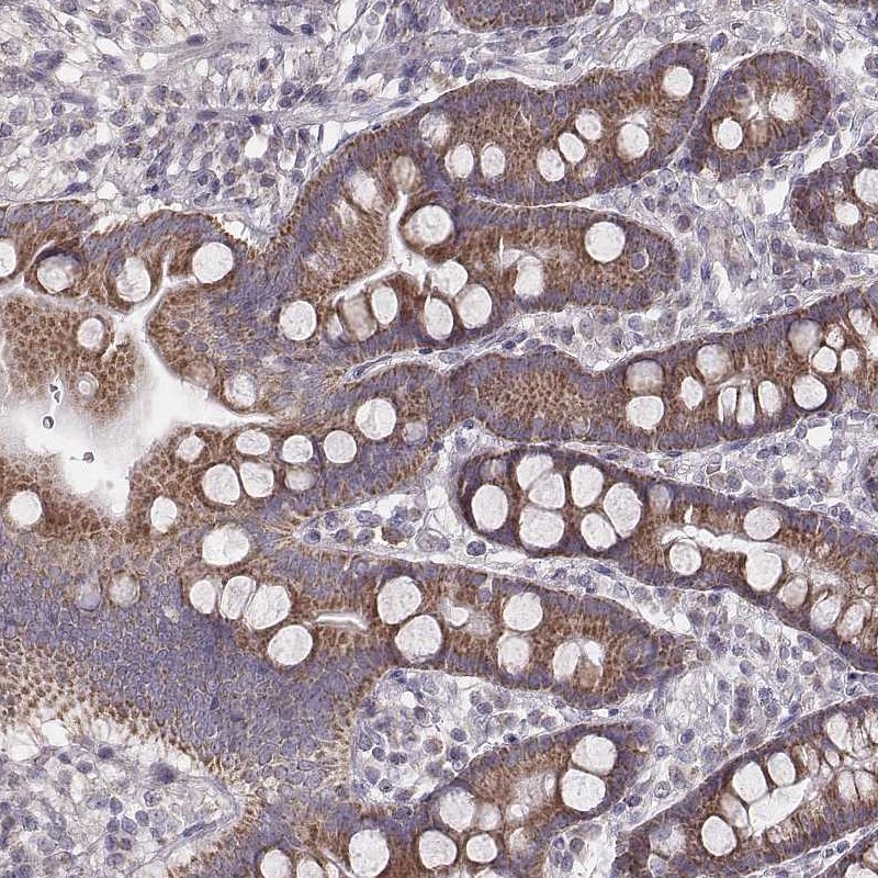 Anti-MRPS27 Antibody
