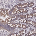 Anti-MRPS27 Antibody