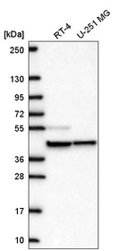 Western blot analysis in human cell line RT-4 and human cell line U-251 MG.