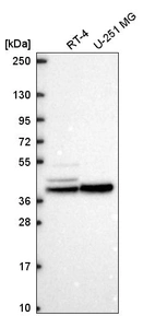 Anti-KCNJ14 Antibody