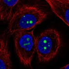 Immunofluorescent staining of human cell line HaCaT shows localization to nucleoli.
