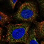 Anti-ARHGEF18 Antibody