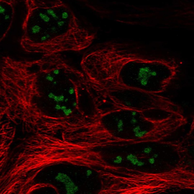 Anti-CC2D2B Antibody