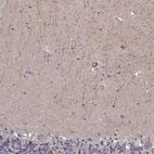 Anti-RIT2 Antibody