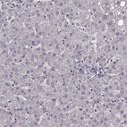 Immunohistochemical staining of human liver shows no positivity in hepatocytes as expected.