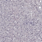 Immunohistochemical staining of human liver shows no positivity in hepatocytes as expected.