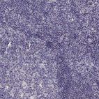 Immunohistochemical staining of human tonsil shows no positivity in non-germinal center cells as expected.