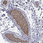Anti-APOA2 Antibody