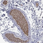 Anti-APOA2 Antibody