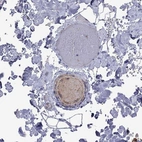 Immunohistochemical staining of human skeletal muscle shows moderate positivity in plasma.