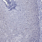 Immunohistochemical staining of human skin shows negative positivity in squamous epithelial cells as expected.