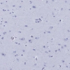 Immunohistochemical staining of human cerebral cortex shows negative positivity in neurons as expected.