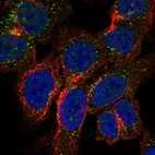 Anti-TRPM3 Antibody
