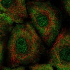 Anti-LTB4R2 Antibody