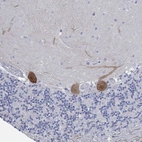 Immunohistochemical staining of human cerebellum shows strong cytoplasmic positivity in Purkinje cells.