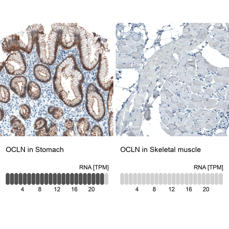 Anti-OCLN Antibody