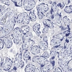 Immunohistochemical staining of human placenta shows no positivity in trophoblastic cells as expected.